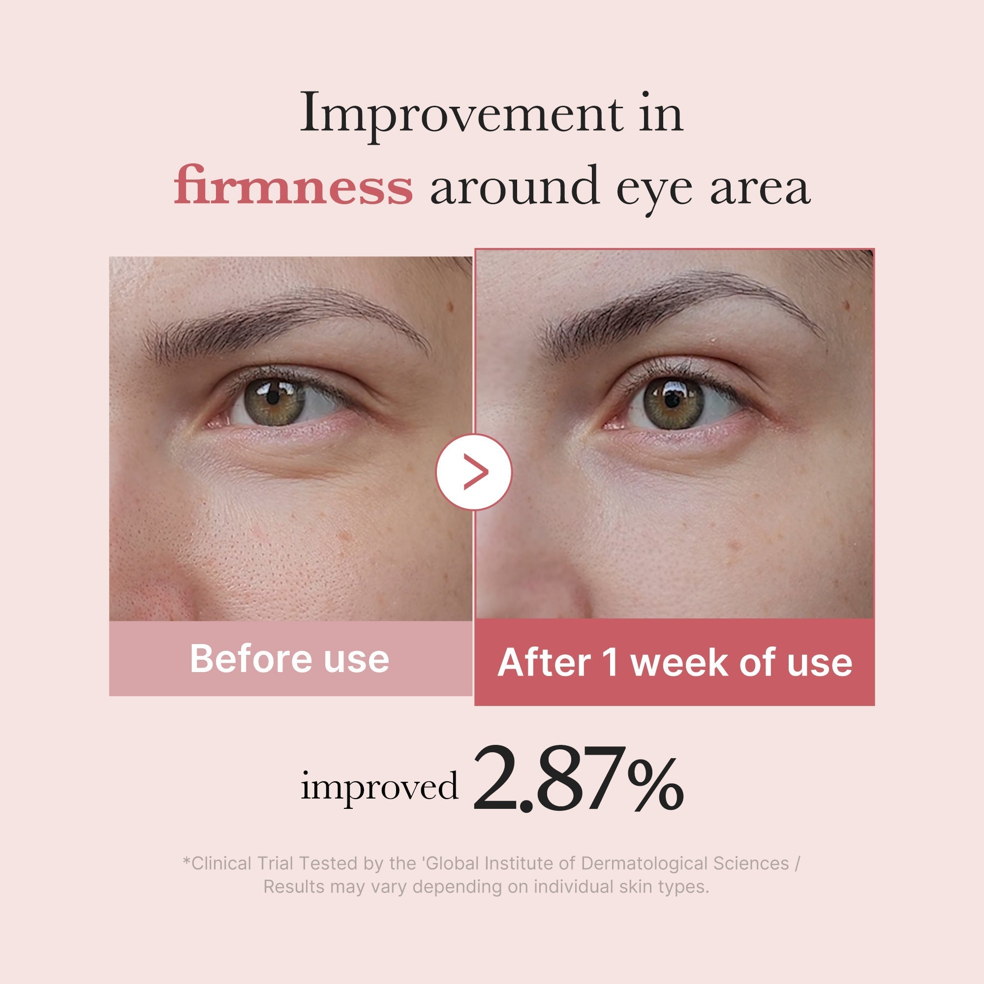 PDRN Pink Peptide Eye Cream